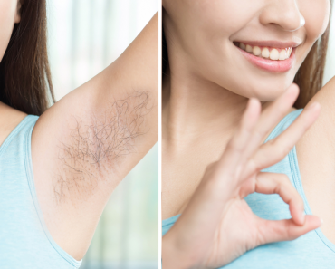 Give a try to this amazing underarm or armpit hair removal natural trick