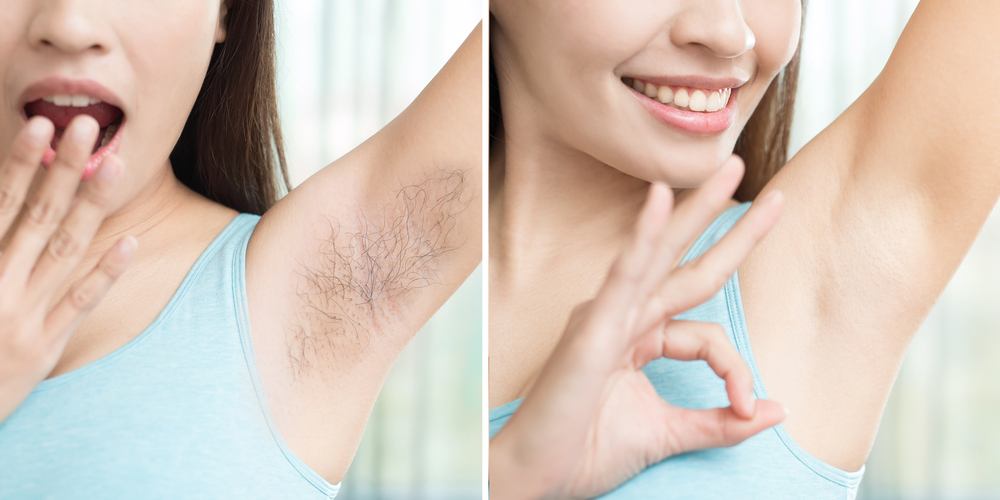 underarm or armpit hair removal naturally